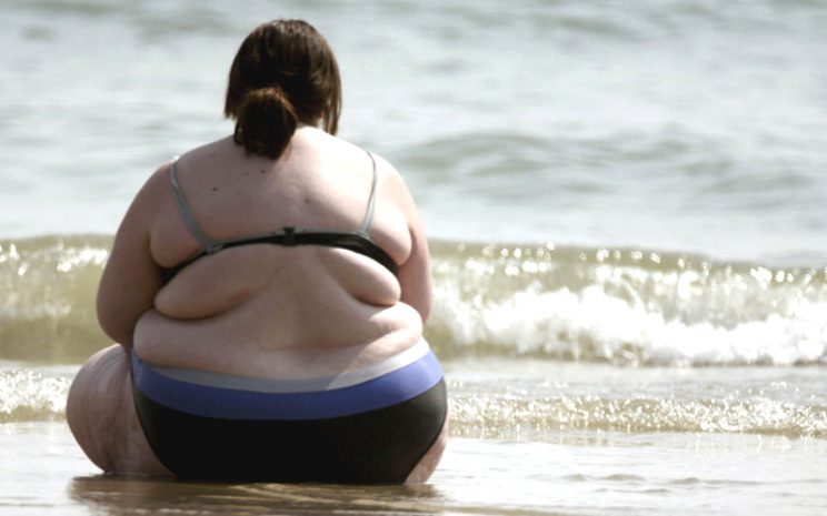 Obesidad no es igual para todos: hombres y mujeres enfrentan riesgos distintos para su salud